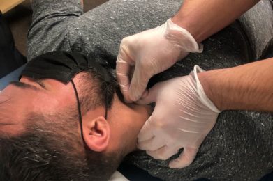 Sternocleidomastoid needling